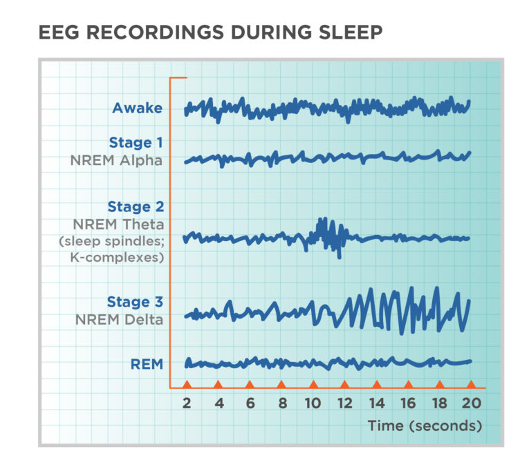 EEG