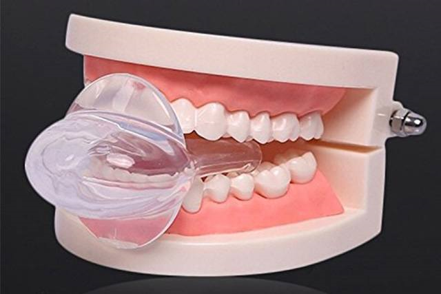 Tongue retaining device (TRD)