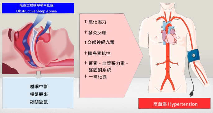 hypertension2